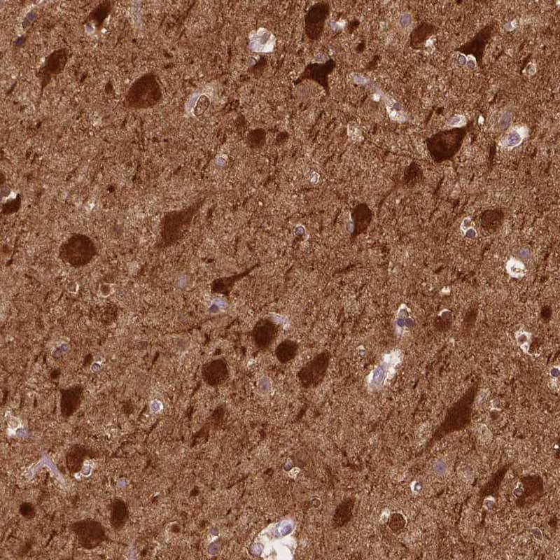 Staining of human cerebral cortex shows strong cytoplasmic positivity in neurons.