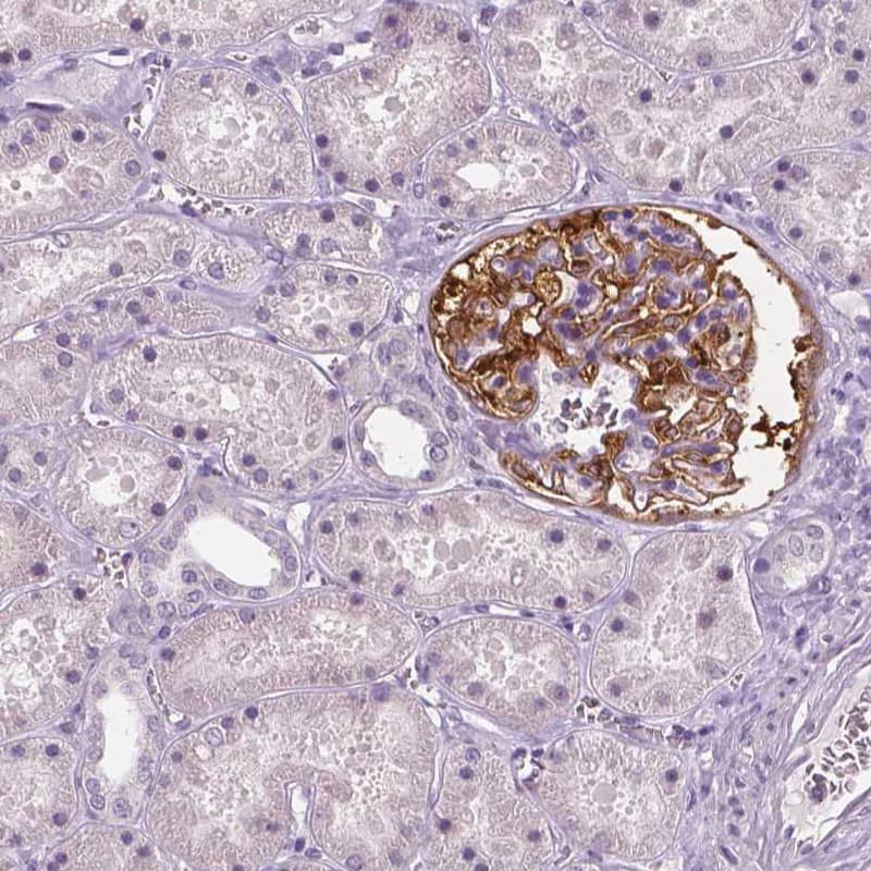 Staining of human kidney shows strong cytoplasmic positivity in cells in glomeruli.