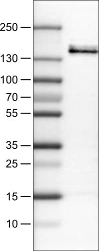 Lane 1: Marker [kDa]Lane 2: Human cell line RT-4