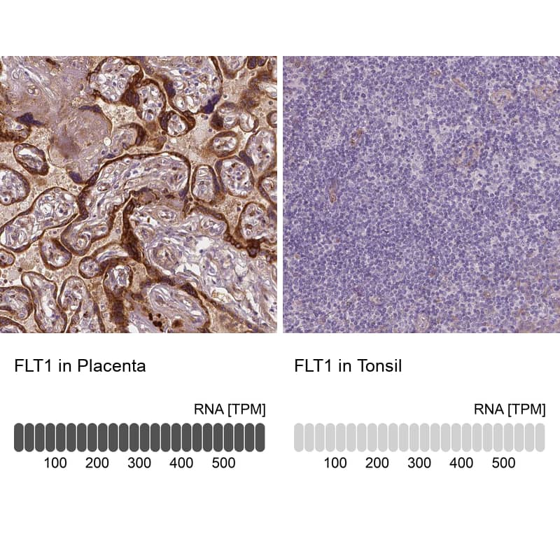 Analysis in human placenta and tonsil tissues using NBP3-43978 antibody. Corresponding VEGFR1/Flt-1 RNA-seq data are presented for the same tissues.