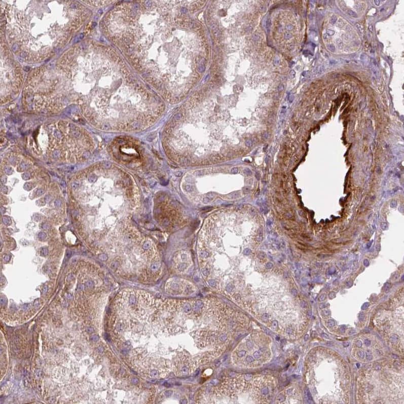 Staining of human kidney shows strong cytoplasmic positivity in endothelial cells.
