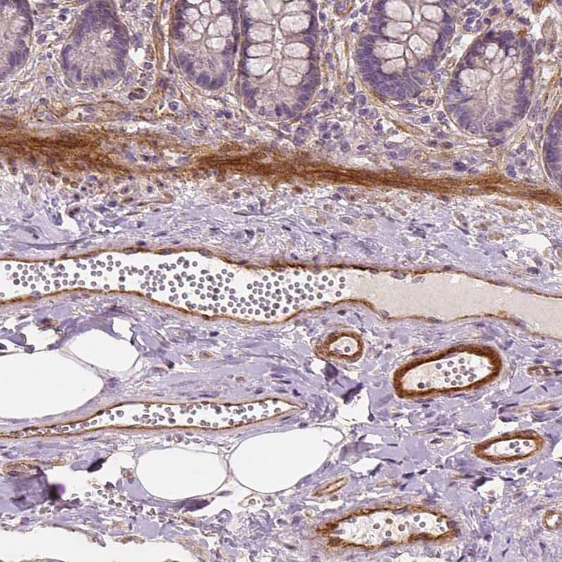 Staining of human small intestine shows moderate to strong cytoplasmic positivity in endothelial cells, as well as positivity in smooth muscle cells.