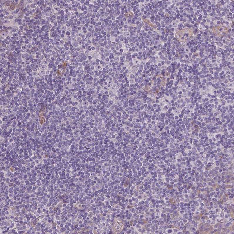 Staining of human tonsil shows no positivity in lymphoid cells as expected.
