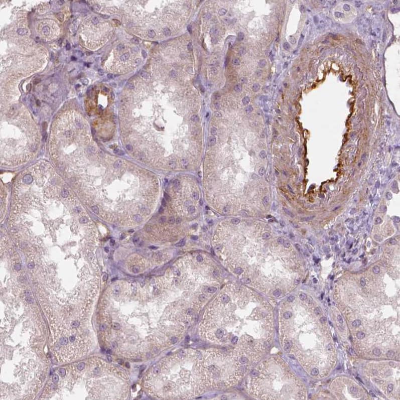 Staining of human kidney shows strong cytoplasmic positivity in endothelial cells.
