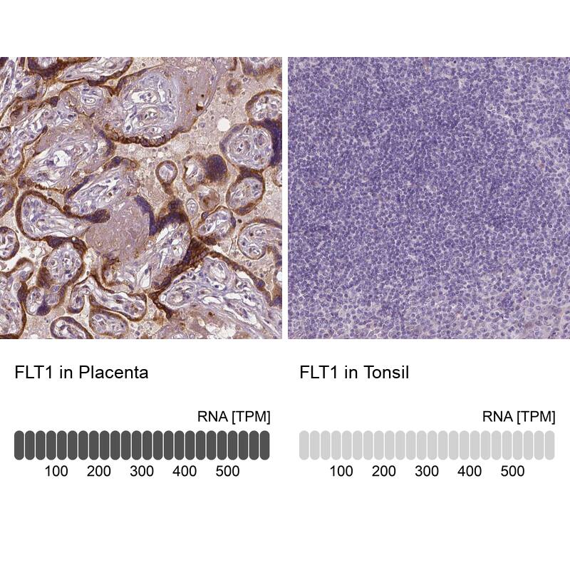 Analysis in human placenta and tonsil tissues using NBP3-43979 antibody. Corresponding VEGFR1/Flt-1 RNA-seq data are presented for the same tissues.