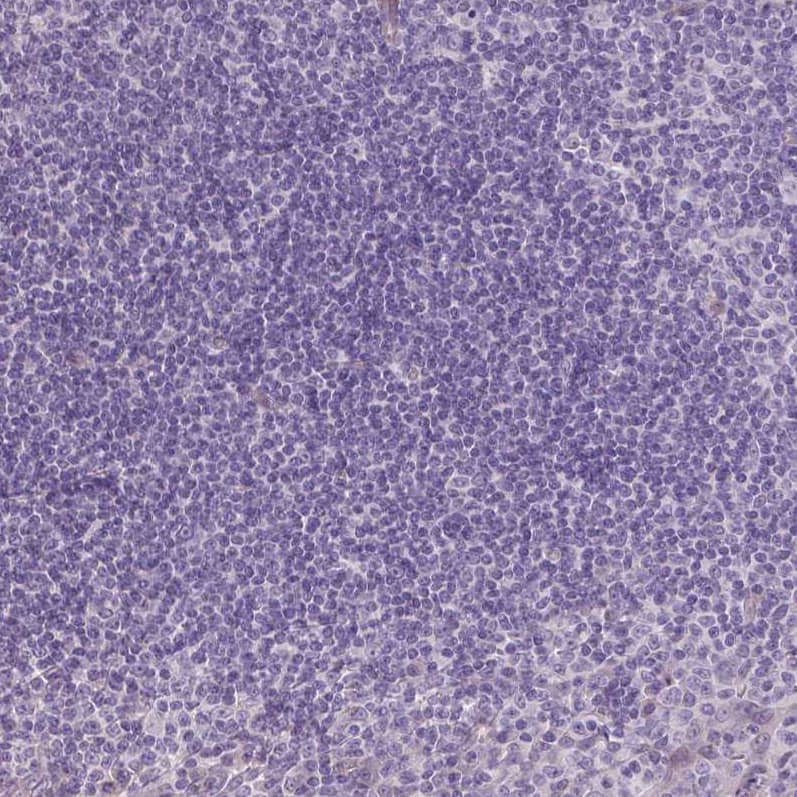 Staining of human tonsil shows no cytoplasmic positivity in lymphoid cells as expected.
