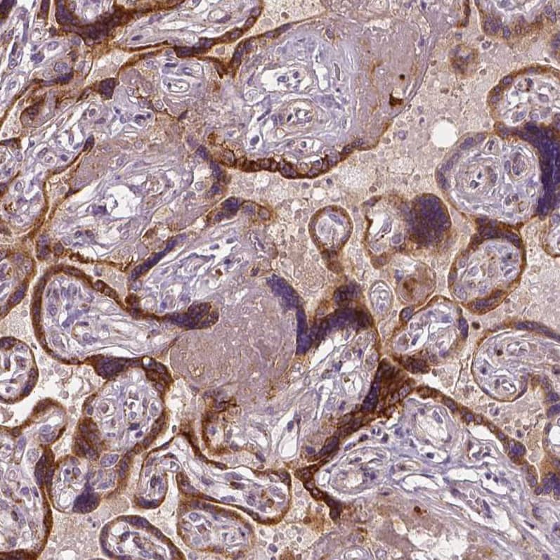 Staining of human placenta shows strong cytoplasmic positivity in trophoblastic cells.
