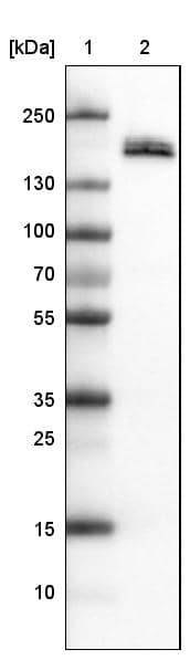 Lane 1: Marker [kDa]Lane 2: Human kidney tissue lysate
