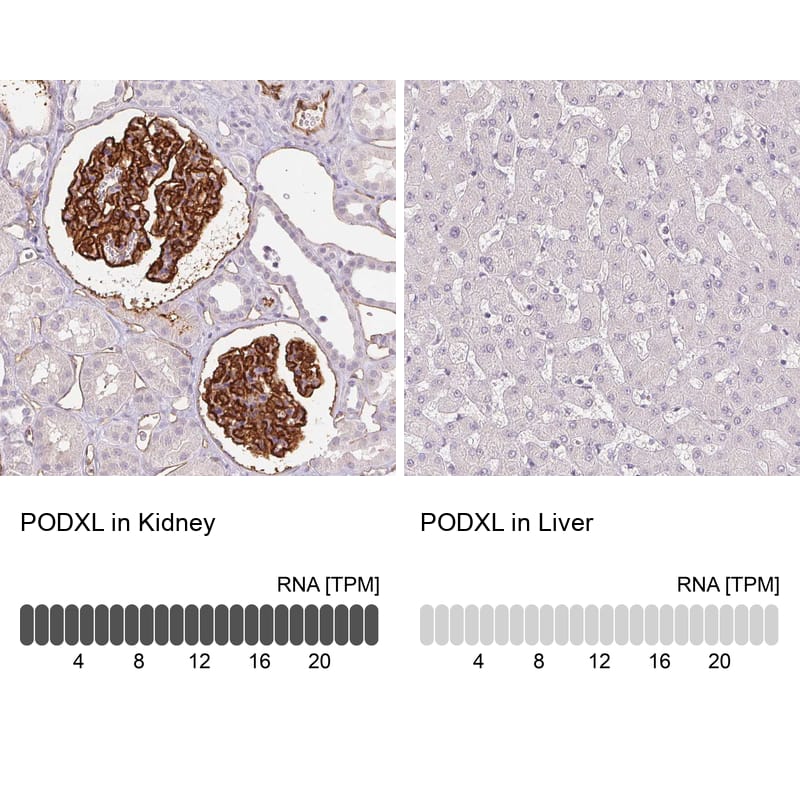 Analysis in human kidney and liver tissues using NBP3-43980 antibody. Corresponding Podocalyxin Like RNA-seq data are presented for the same tissues.