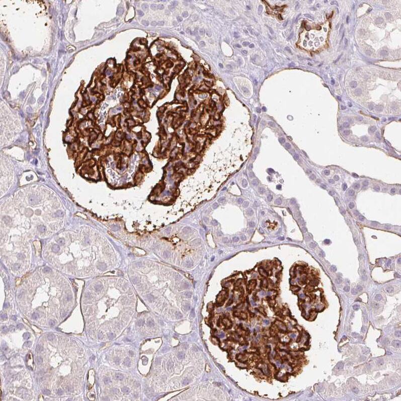 Staining of human kidney shows strong membranous positivity in cells in glomeruli, as well as endothelial cells.