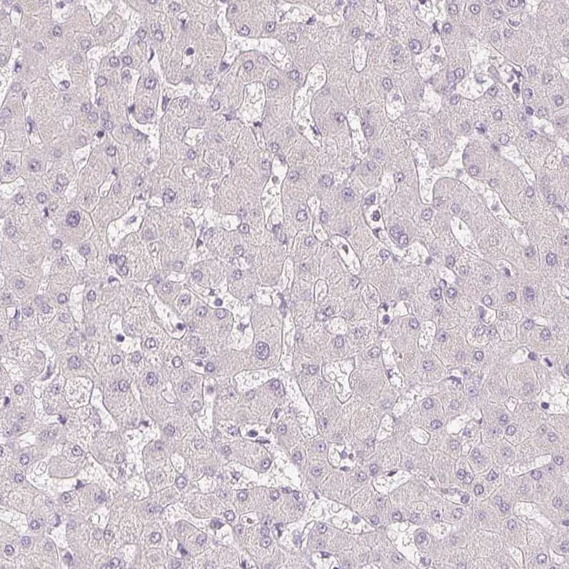 Staining of human liver shows no positivity in hepatocytes as expected.