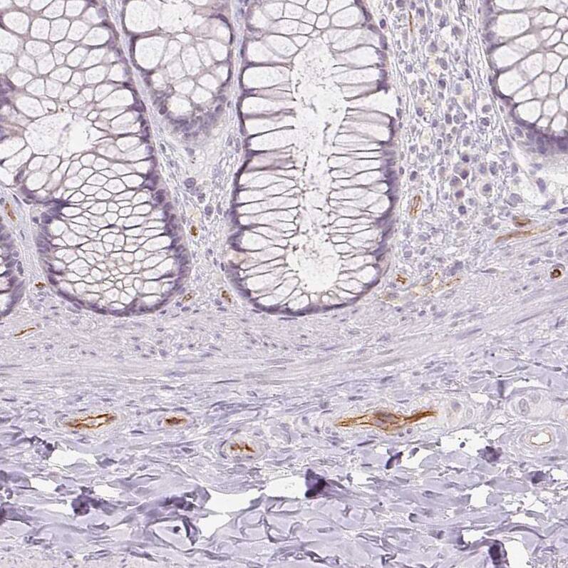 Staining of human rectum shows moderate membranous positivity in endothelial cells.