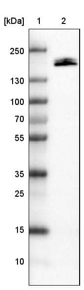 Lane 1: Marker [kDa]Lane 2: Human kidney tissue lysate