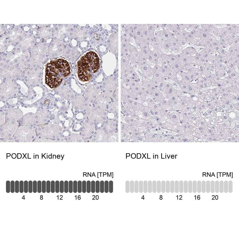 Analysis in human kidney and liver tissues using NBP3-43981 antibody. Corresponding Podocalyxin Like RNA-seq data are presented for the same tissues.