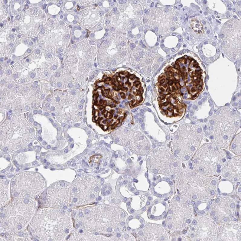 Staining of human kidney shows strong membranous positivity in cells in glomeruli.