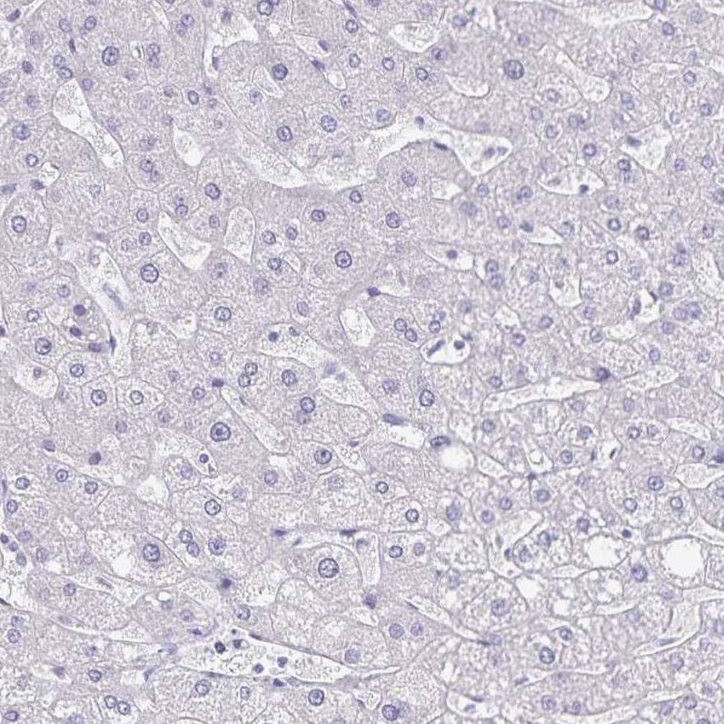 Staining of human liver shows no positivity in hepatocytes as expected.