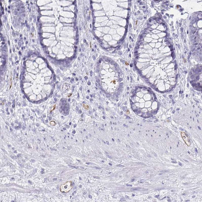 Staining of human rectum shows weak to moderate membranous positivity in endothelial cells.