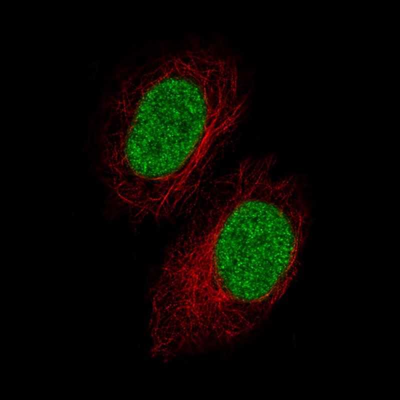 Staining of A549 cells using the Anti-GDF-15 monoclonal antibody) .