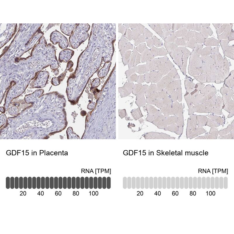 Analysis in human placenta and skeletal muscle tissues using NBP3-43983 antibody. Corresponding GDF-15 RNA-seq data are presented for the same tissues.