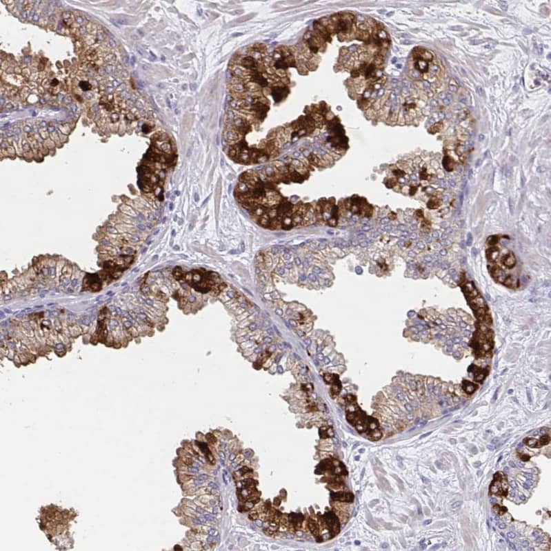 Staining of human prostate shows strong granular cytoplasmic positivity in a subset of glandular cells.