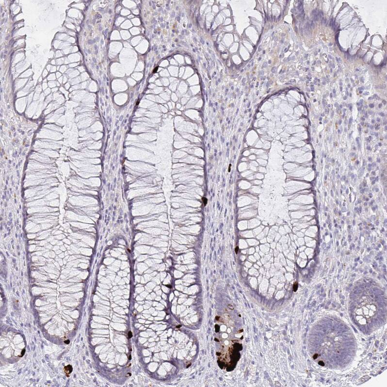 Staining of human rectum shows strong cytoplasmic positivity in enteroendocrine cells.