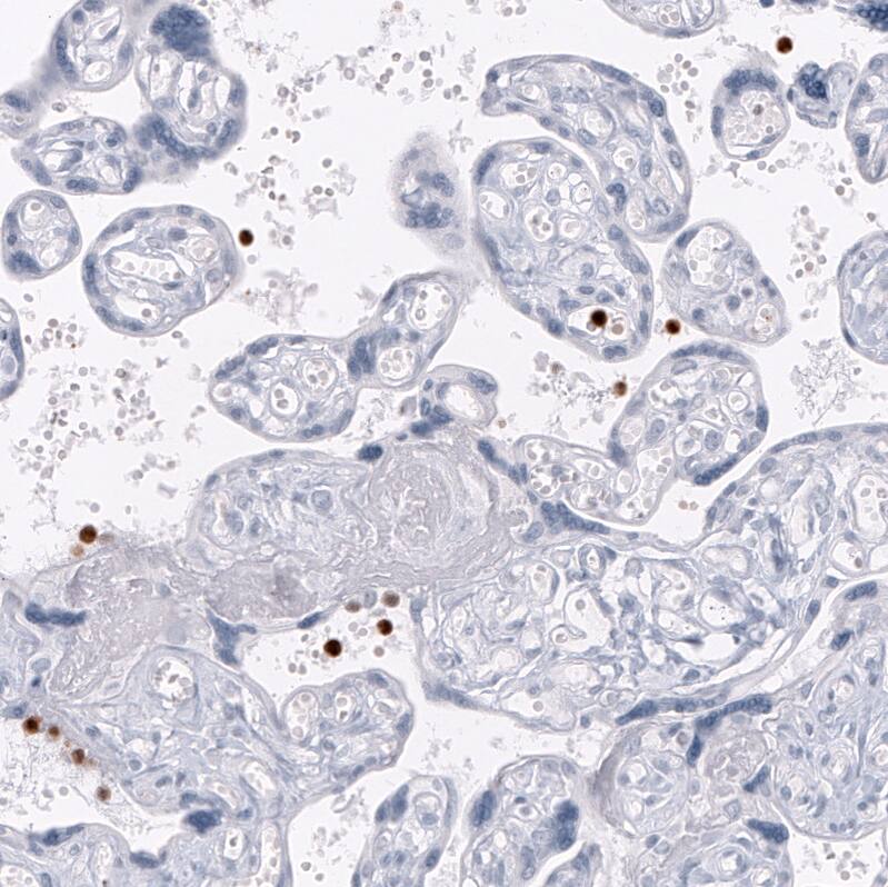 Staining of human placenta shows strong cytoplasmic positivity in a subset of lymphoid cells.