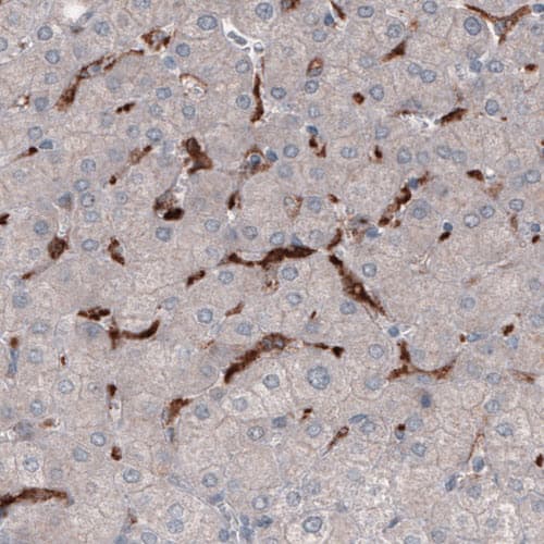 Staining of human liver shows strong immunoreactivity in Kupffer cells.