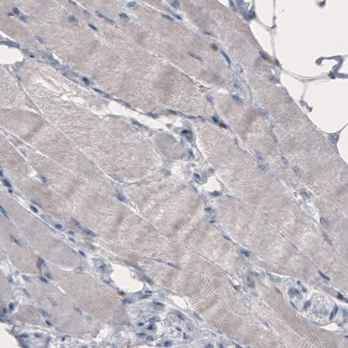 Staining of human skeletal muscle shows absence of immunoreactivity (negative control).