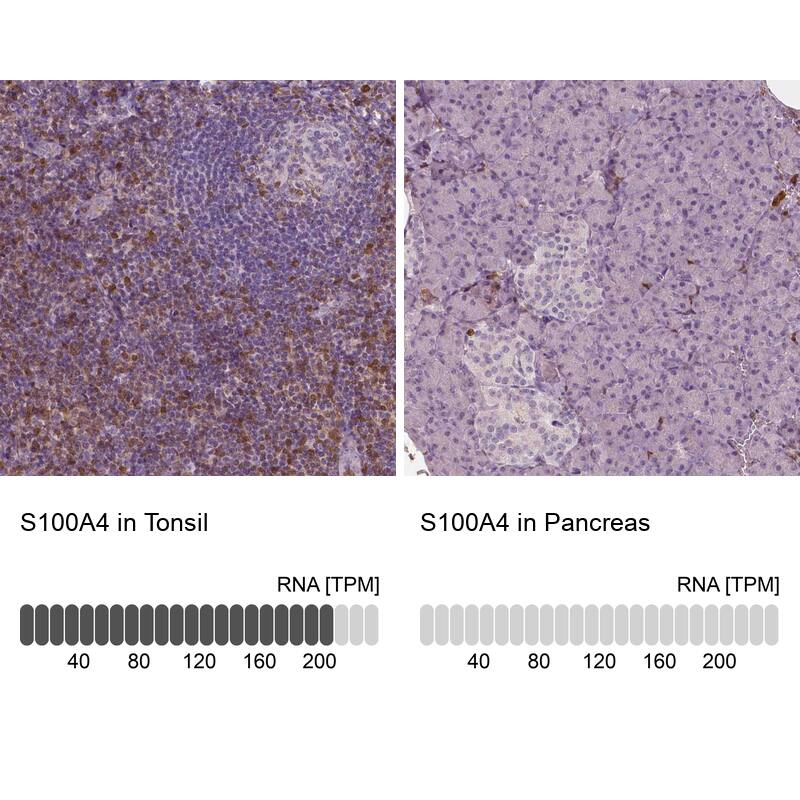 Analysis in human tonsil and pancreas tissues using NBP3-43987 antibody. Corresponding S100A4 RNA-seq data are presented for the same tissues.