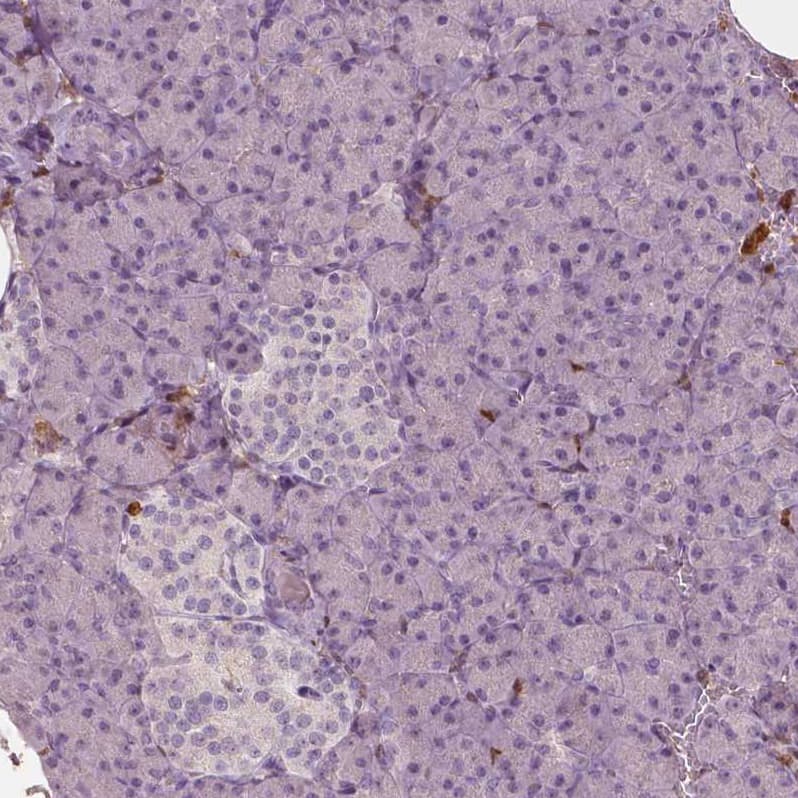 Staining of human pancreas shows no positivity in either islets of Langerhans or exocrine glandular cells as expected.