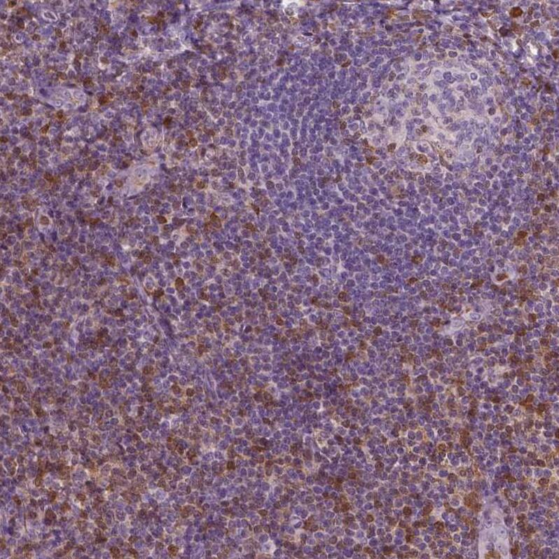 Staining of human tonsil shows moderate to strong cytoplasmic positivity, mainly in non - germinal center cells.