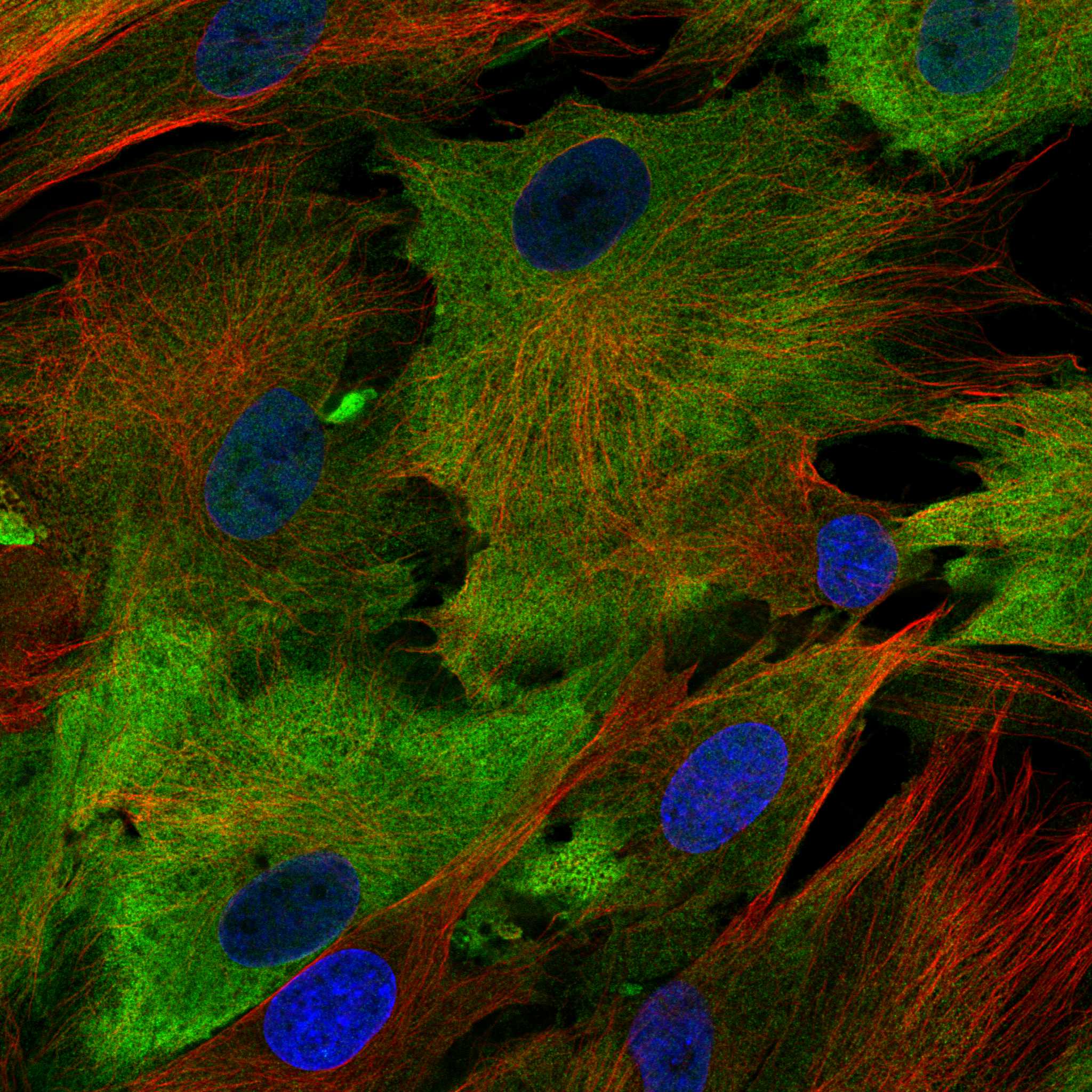 Staining of BJ cells using the anti-S100A4 monoclonal antibody) .
