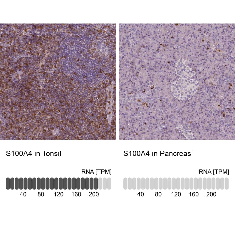 Analysis in human tonsil and pancreas tissues using NBP3-43988 antibody. Corresponding S100A4 RNA-seq data are presented for the same tissues.