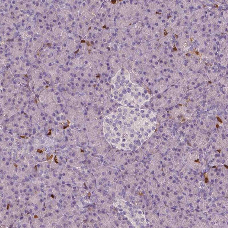 Staining of human pancreas shows no positivity in either islets of Langerhans or exocrine glandular cells as expected.