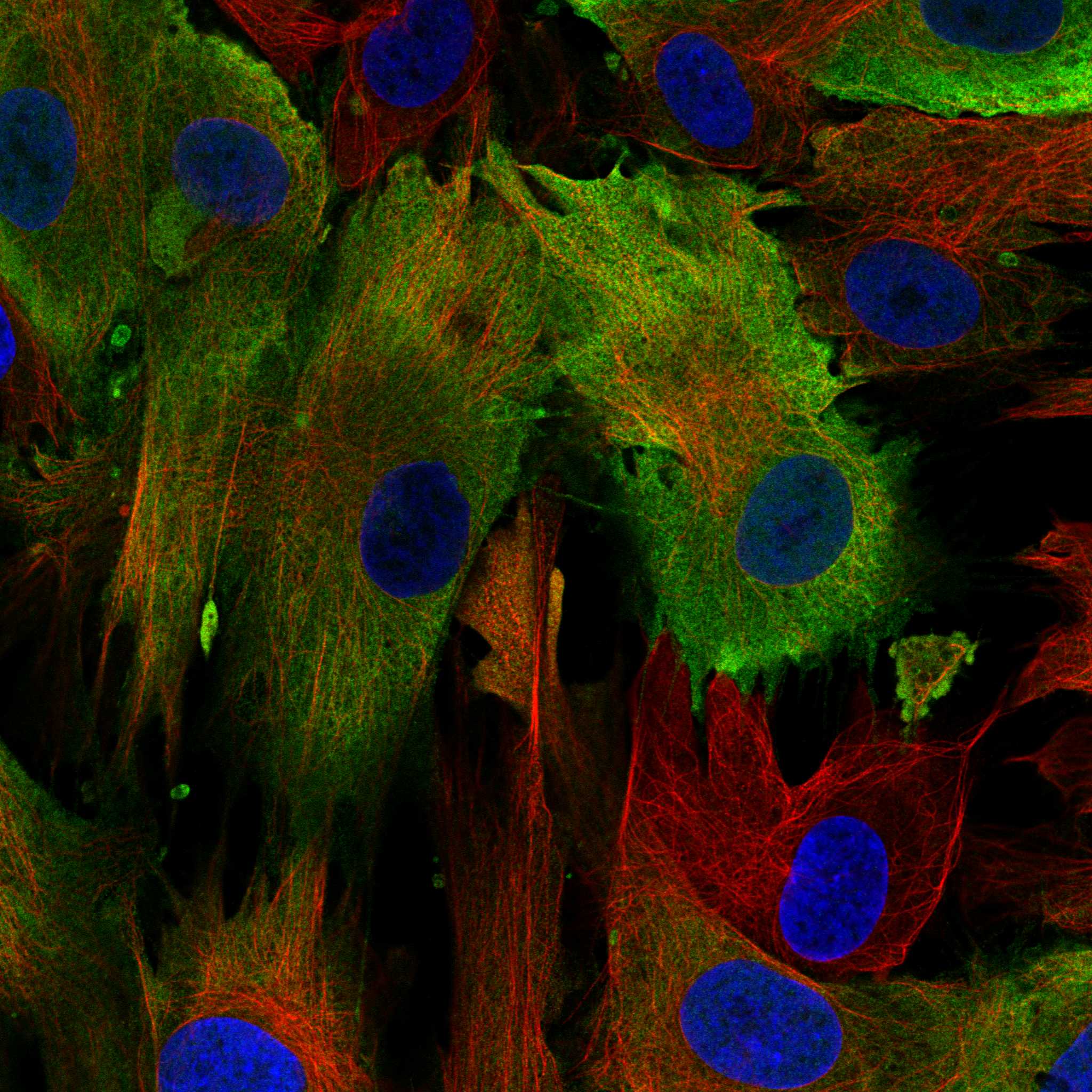 Staining of BJ cells using the anti-S100A4 monoclonal antibody) .
