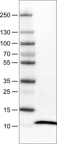 Lane 1: Marker [kDa]Lane 2: Human tonsil tissue lysate