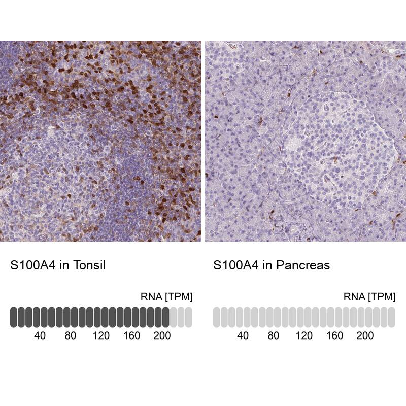 Analysis in human tonsil and pancreas tissues using NBP3-43989 antibody. Corresponding S100A4 RNA-seq data are presented for the same tissues.