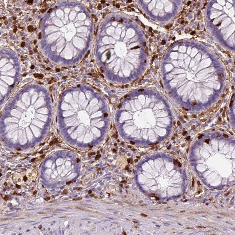 Staining of human rectum shows strong cytoplasmic positivity in lymphoid cells.