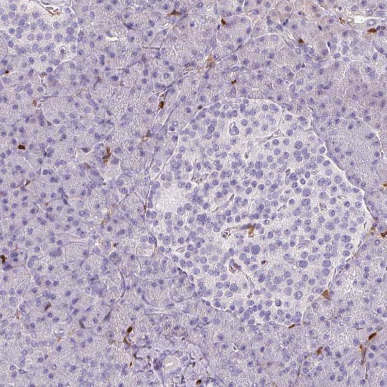 Staining of human pancreas shows no positivity in either Langerhans islets or exocrine glandular cells as expected.