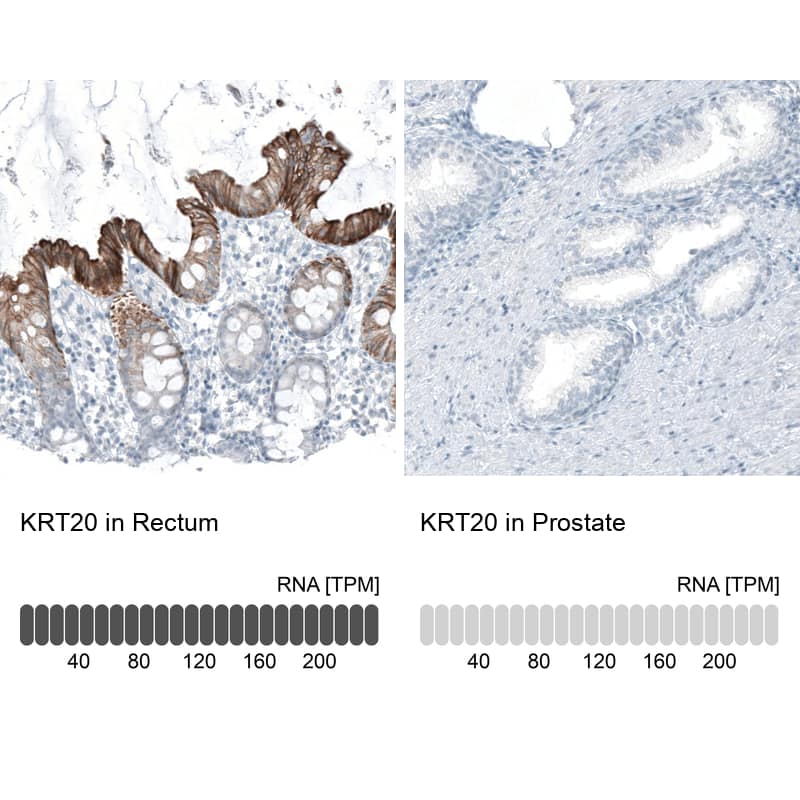 Analysis in human rectum and prostate tissues using NBP3-43990 antibody. Corresponding Cytokeratin 20 RNA-seq data are presented for the same tissues.