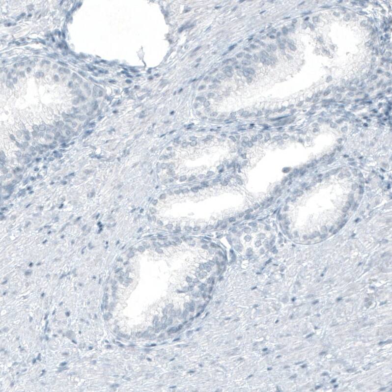 Staining of human prostate shows no positivity in glandular cells as expected.