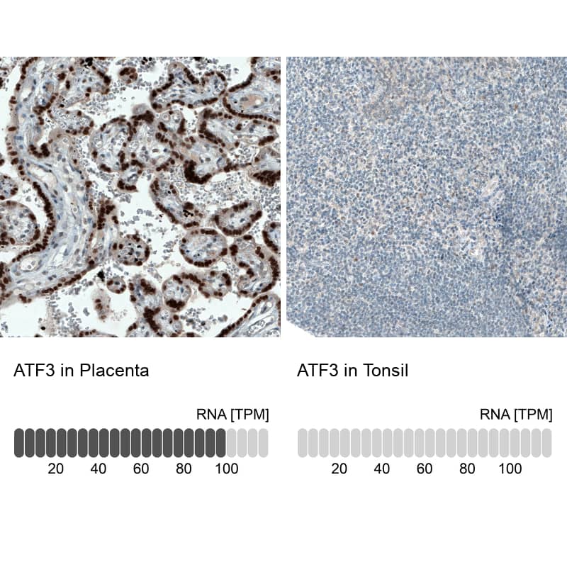 Analysis in human placenta and tonsil tissues using NBP3-43991 antibody. Corresponding ATF3 RNA-seq data are presented for the same tissues.