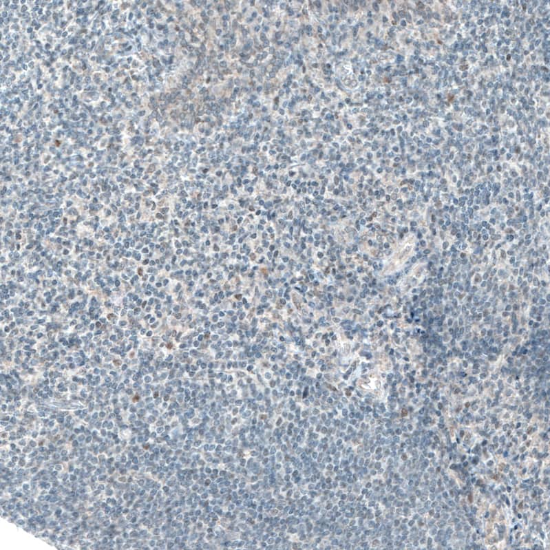 Staining of human tonsil shows no positivity in lymphoid cells as expected.