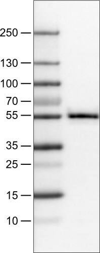 Lane 1: Marker [kDa]Lane 2: Human cell line U-251 MG