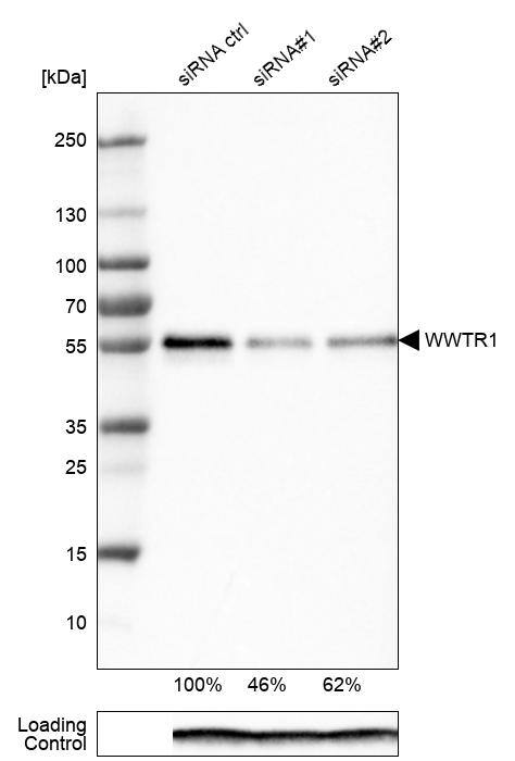 Analysis in EFO-21 cells transfected with control siRNA, target specific siRNA probe #1 and #2, using Anti-TAZ/WWTR1 antibody. Remaining relative intensity is presented. Loading control: Anti-PPIB.