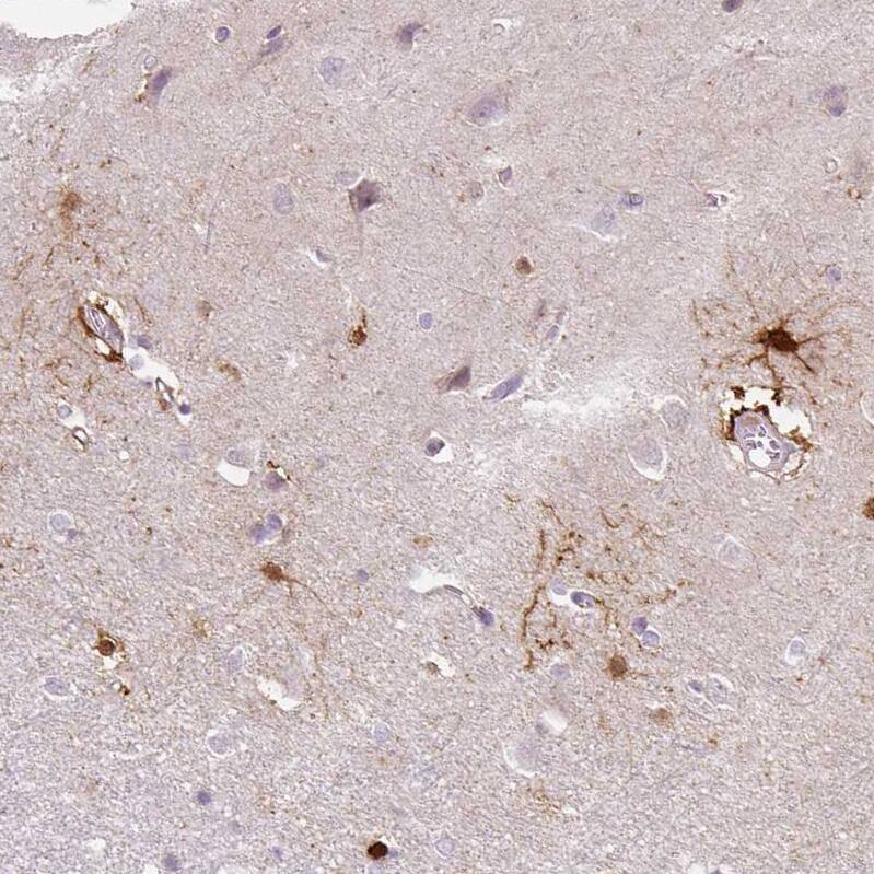 Staining of human cerebral cortex shows moderate to strong cytoplasmic positivity in glial cells.