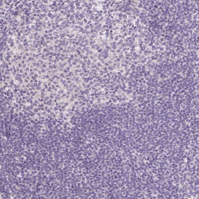 Staining of human tonsil shows no positivity in non-germinal center cells as expected.