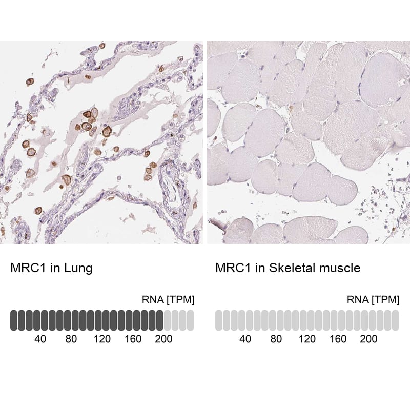 Analysis in human lung and skeletal muscle tissues using NBP3-43996 antibody. Corresponding MMR/CD206/Mannose Receptor RNA-seq data are presented for the same tissues.