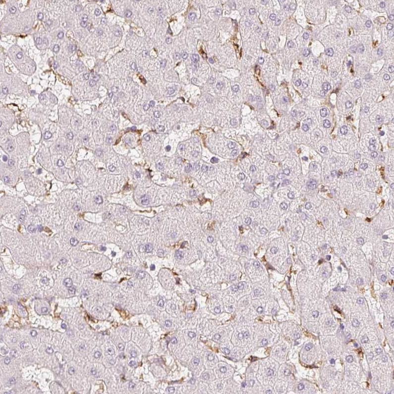 Staining of human liver shows moderate positivity in Kupffer cells.