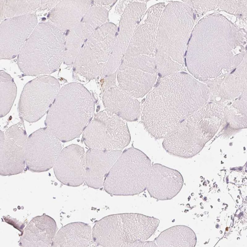 Staining of human skeletal muscle shows no positivity in myocytes as expected.